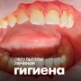 Пристли и подростки: почему важна профессиональная гигиена зубов