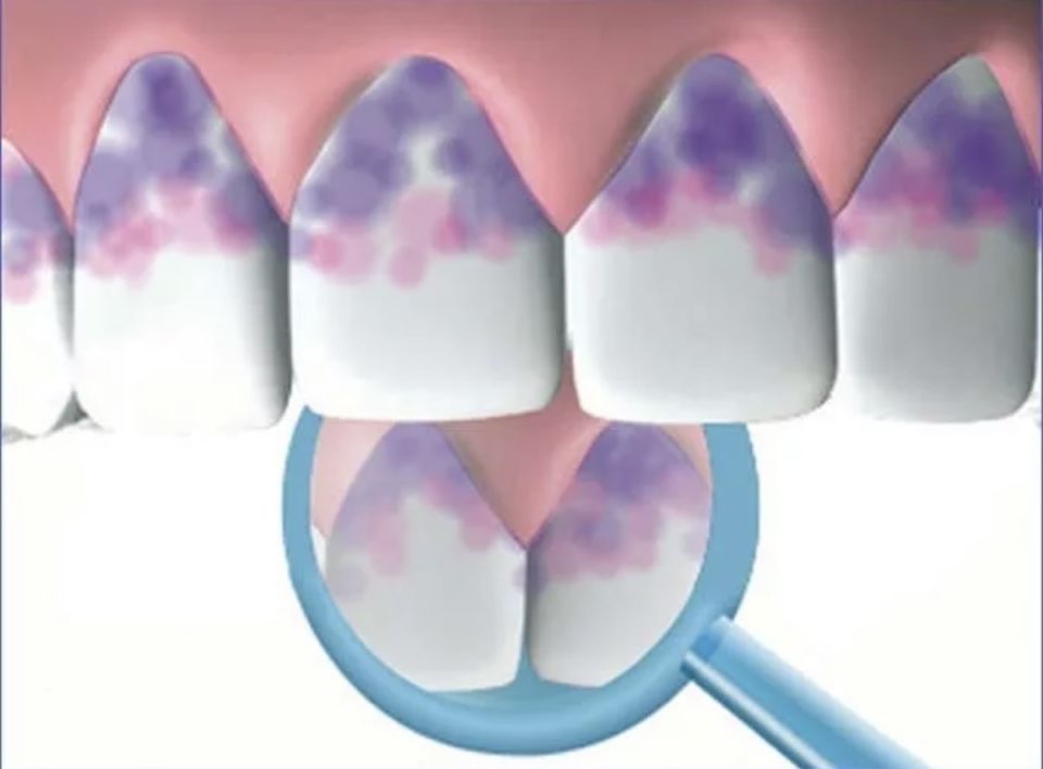 ��������� ������� �����: ����� �������� ������