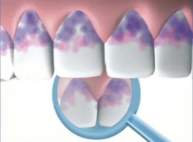 ��������� ������� �����: ����� �������� ������