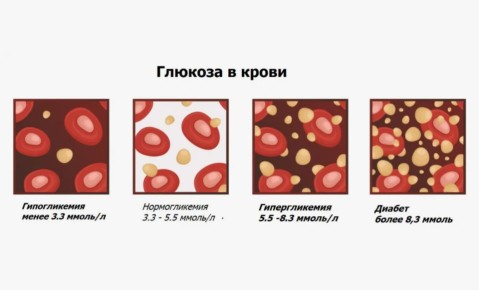 Алкоголь и уровень сахара в крови: что нужно знать каждому