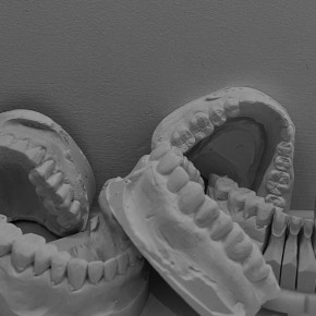 Проблемы с зубами: как избежать серьезных последствий здоровья